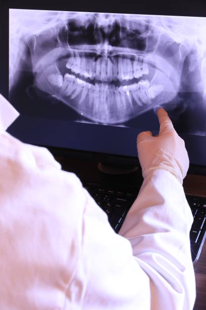 Best Knocked-Out Tooth Emergency  in Helena Valley Northwest, MT